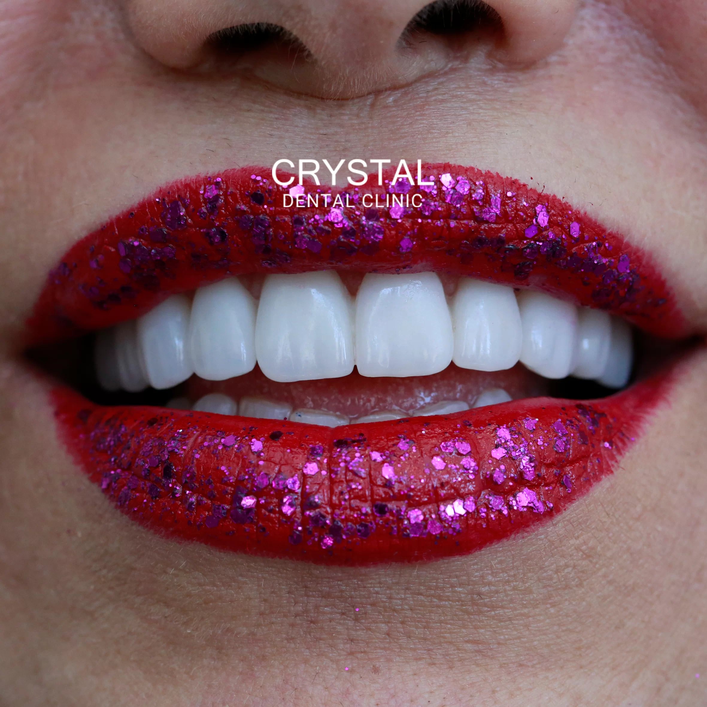 Crystal-Smile02
