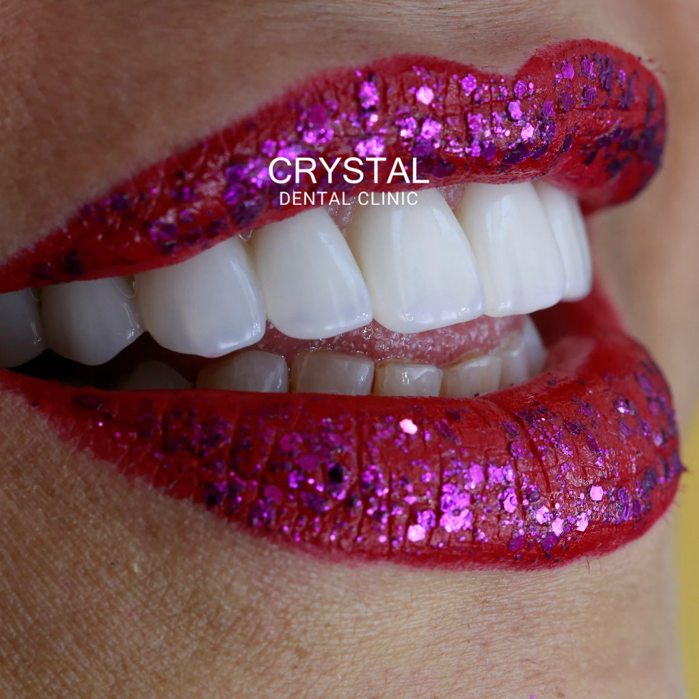 Crystal-Smile03
