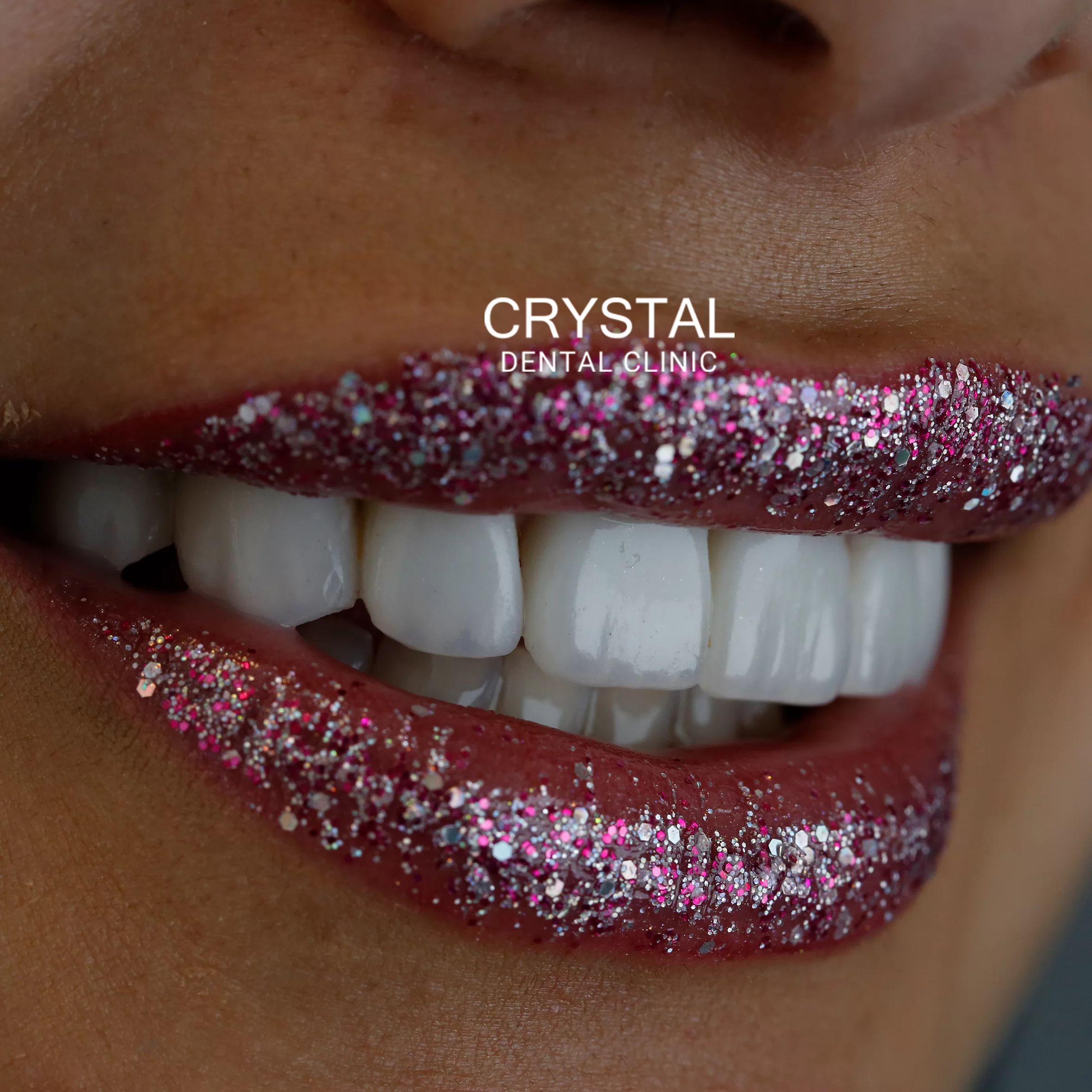 Crystal-Smile2