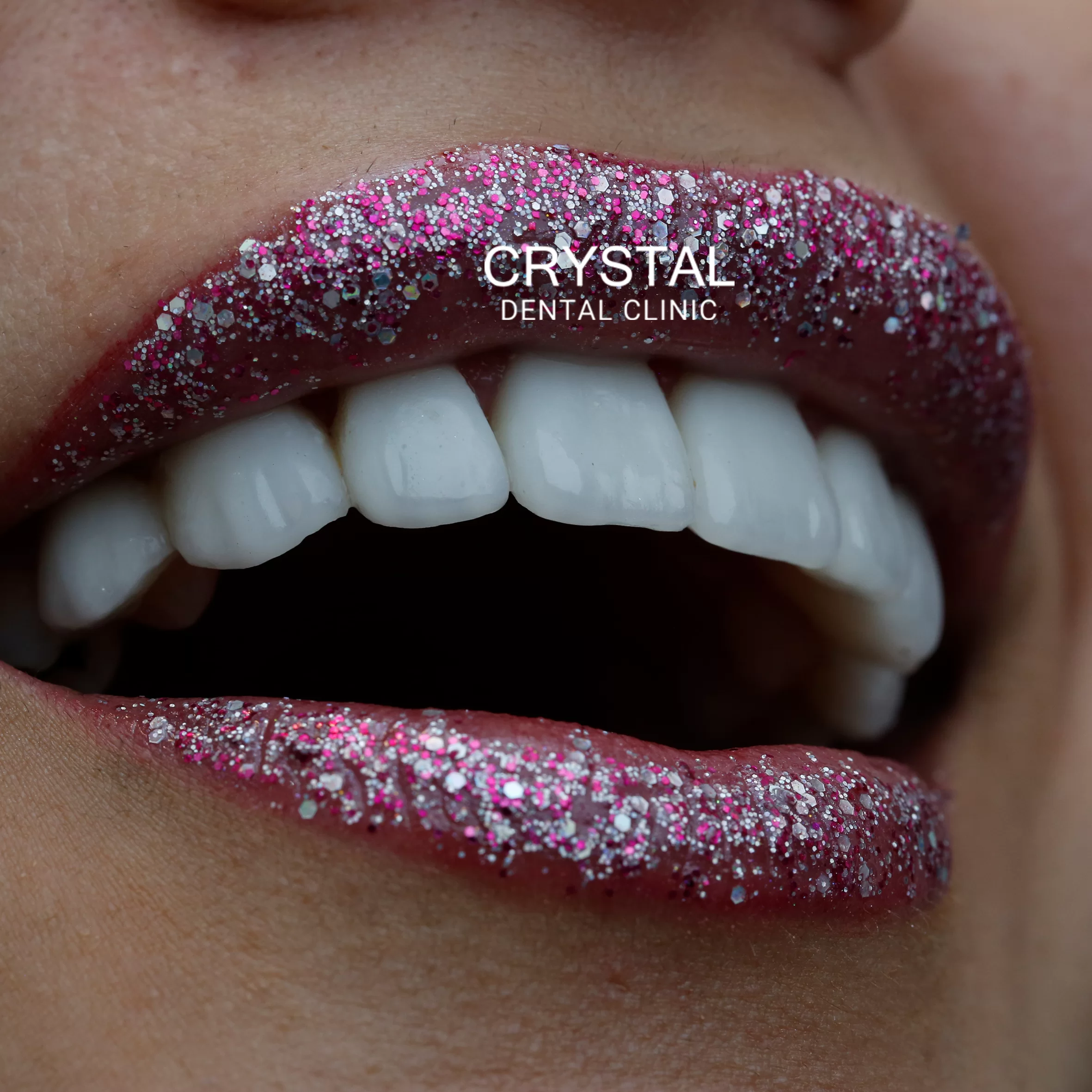 Crystal-Smile3
