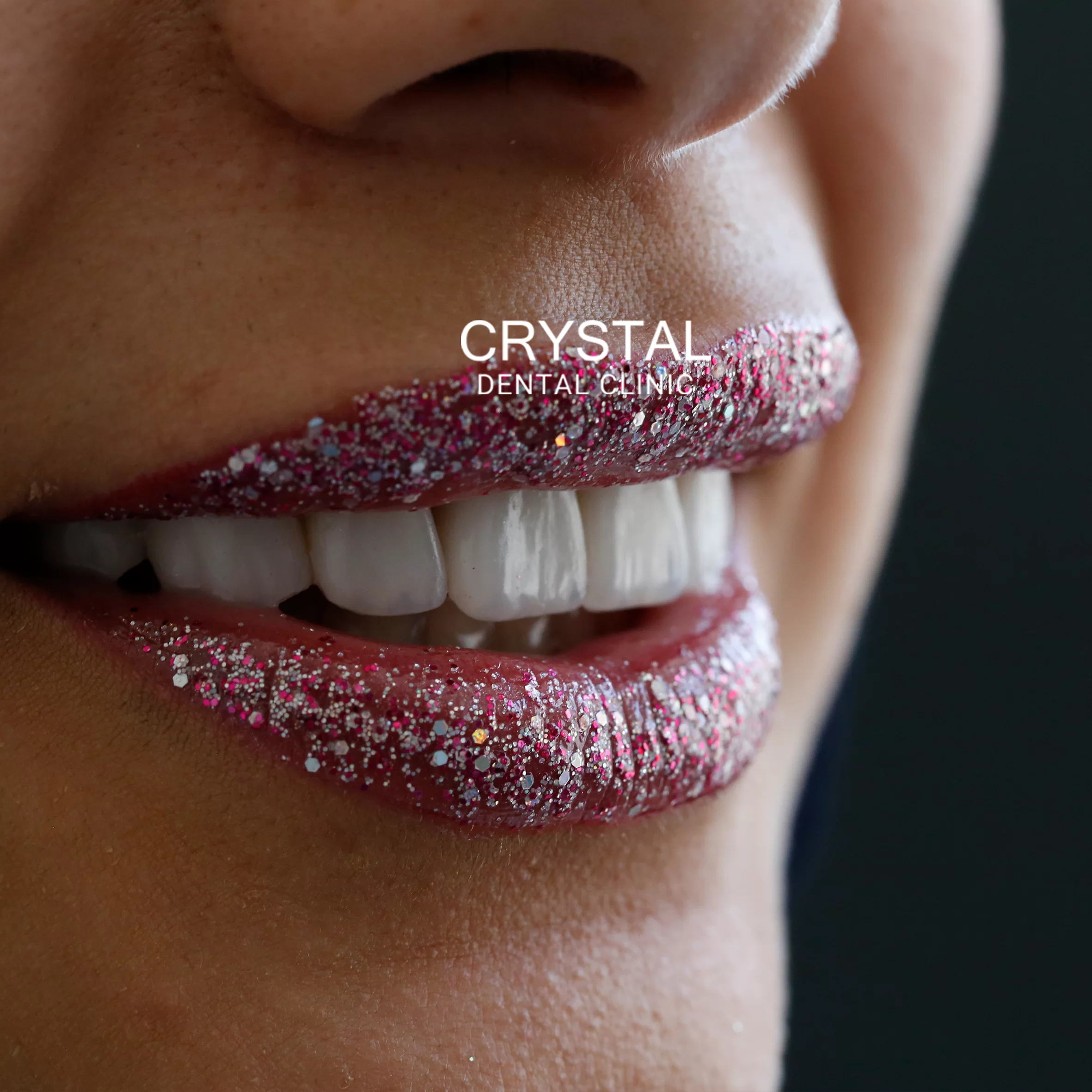 Crystal-Smile4